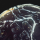 Illustration for article titled Narcotics and Medicines Look Beautiful Under a Microscope